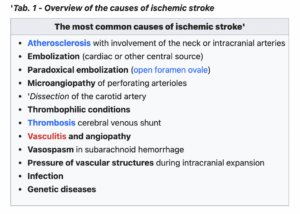 'Tab. 1 - Overview of the causes of ischemic stroke